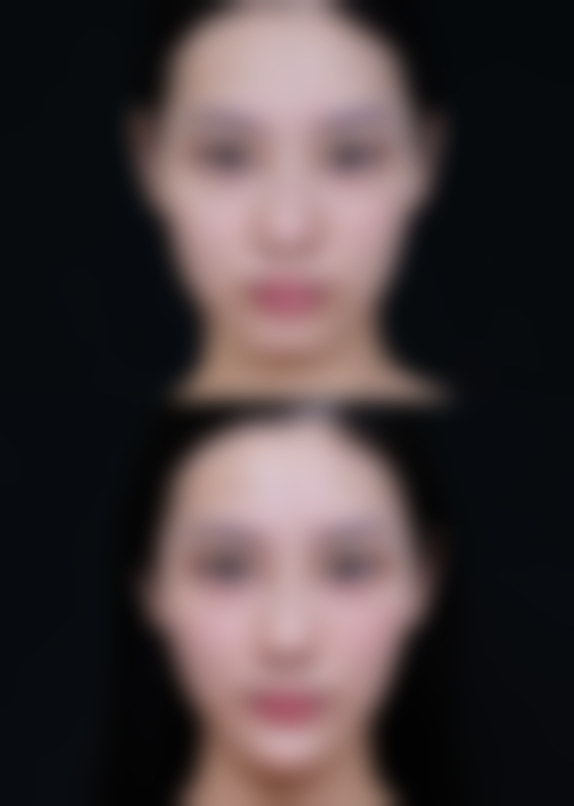 金东一怎么预约？