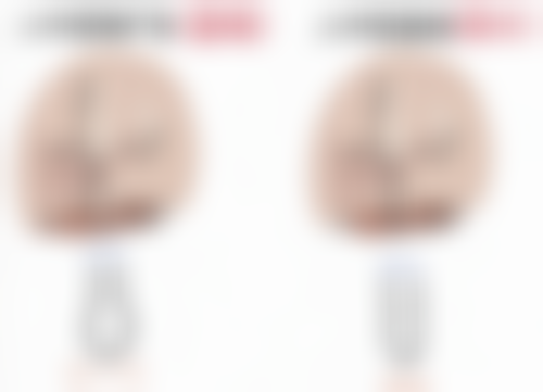 如何为老年人巧妙消除眼袋？多种非手术与手术方法结合，助眼部重焕年轻光彩 