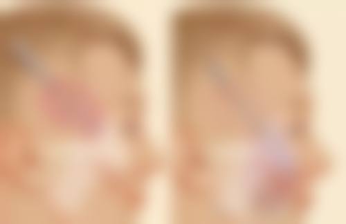 正规机构优势在哪？专精保护，安心无忧