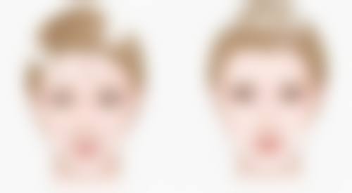 割双眼皮医院的选择要考虑哪些因素？