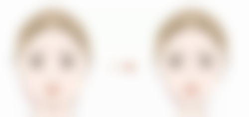 选择合适的医院和医生对手术时长有什么影响？至关重要