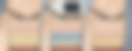 做假体隆胸手术时间长短对术后成效和修复有什么好处？优势明显