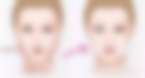 揭秘二:自体脂肪隆胸与假体隆胸哪种好及修复时间