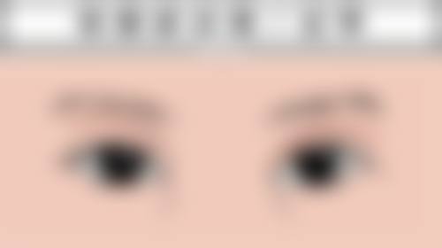 术后备孕与分娩：注意事项保护安心顺产