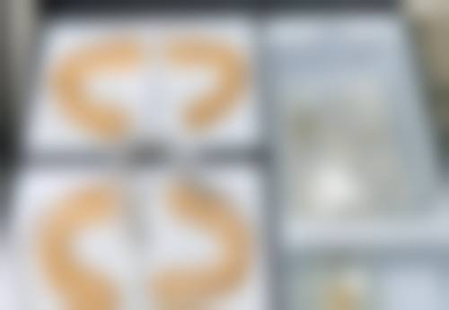 自体毛囊移植:避免感染风险,安心有保护