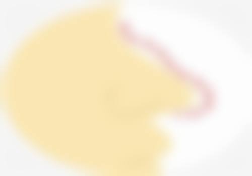 阮雅君在哪家医院