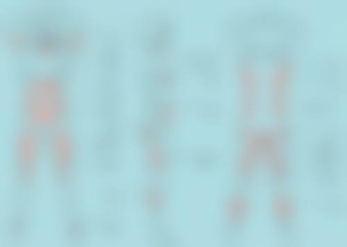 冰敷眼睛能否消眼袋？揭秘冰敷对不同类型眼袋的改善作用及医院专业解决方案 