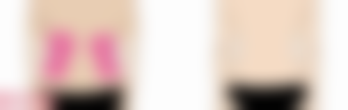 钱雪华怎么预约？