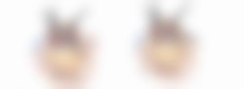 橄榄油能消除眼袋吗？科学改善眼袋的常见方法