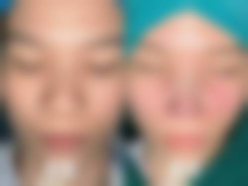 万汉锋怎么预约？