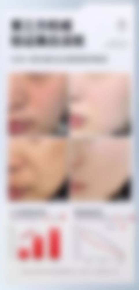 陈剑怎么预约？