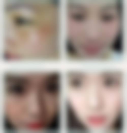 陈剑祛黄褐斑水平怎么样可靠吗？