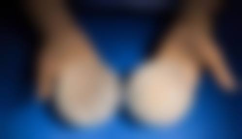 万汉锋鼻整形手术水平怎么样可靠吗？