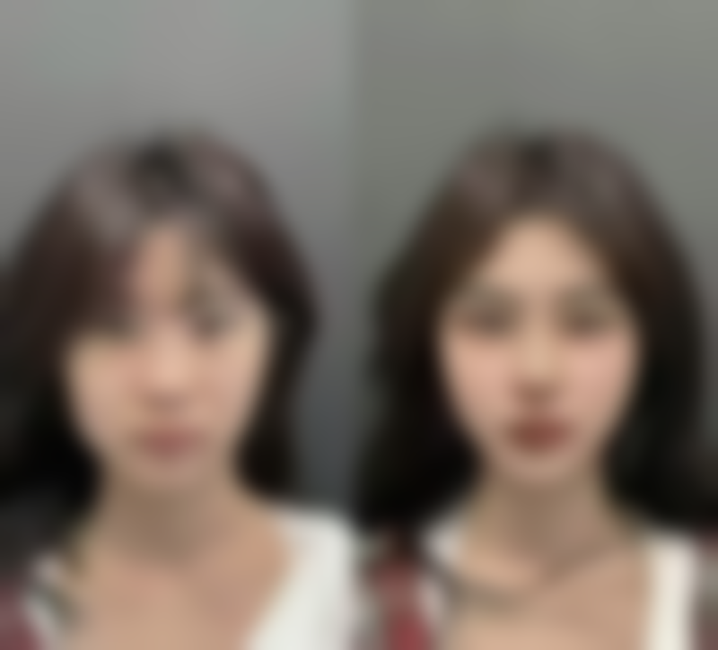 阮雅君怎么预约?