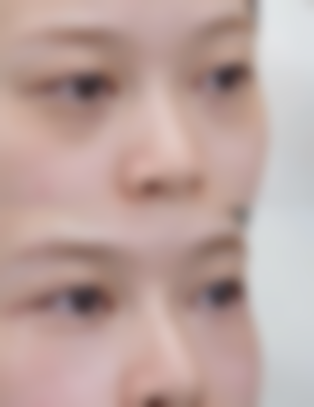 四、上海亚太医疗美容门诊部（外滩店）实例