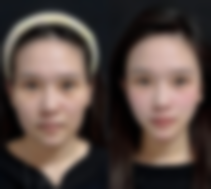 七、唐山辰芃医疗美容诊所真实的顾客评价如下: