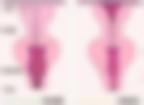 术后护理：让美丽更持久