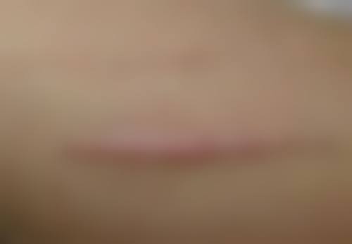 如何巩固祛眼袋成效，保持明亮双眸