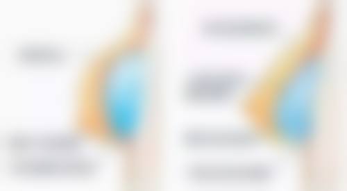 重塑眼美与年龄柔和魅力兼得：50岁的美丽蜕变