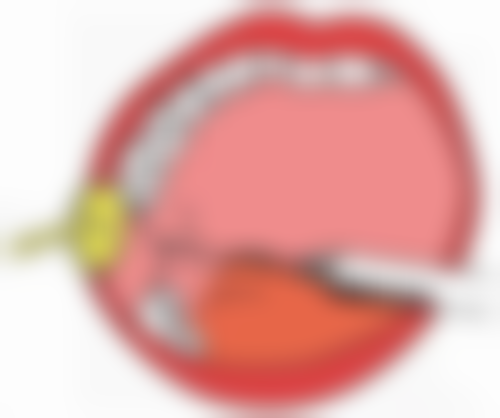 瘦脸针效果通常能维持4 - 6个月，受多因素影响，教你延长效果秘诀！ 