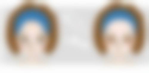 打瘦脸针的优势有哪些？