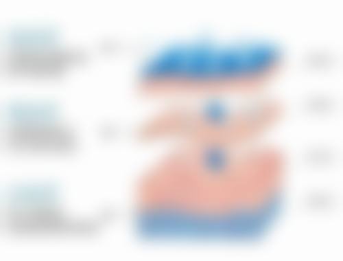 选择靠谱医院，保护瘦脸针成效