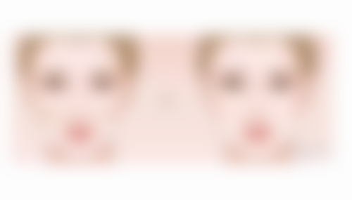 如何快速去除眼袋?轻医美方案显身手