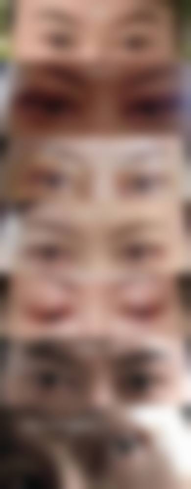 吴溯帆双眼皮手术水平怎么样可靠吗？