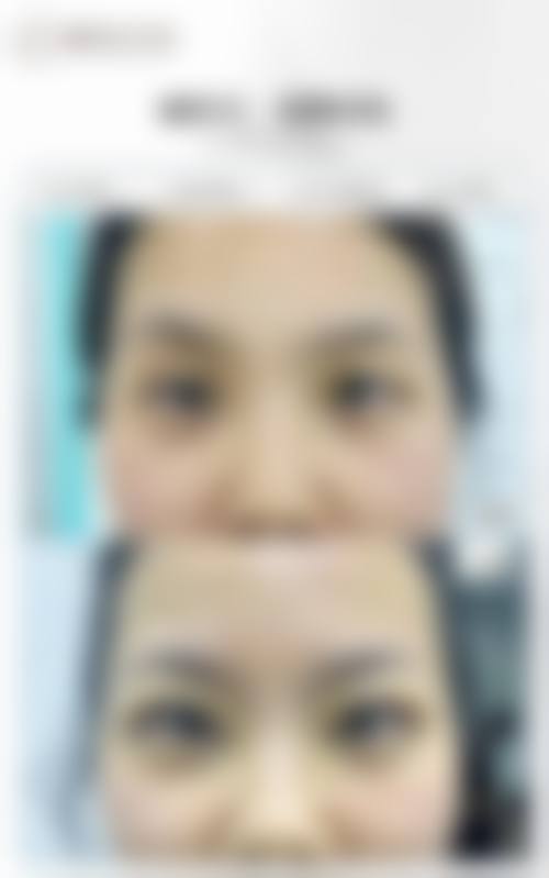 任烨眼鼻综合实例