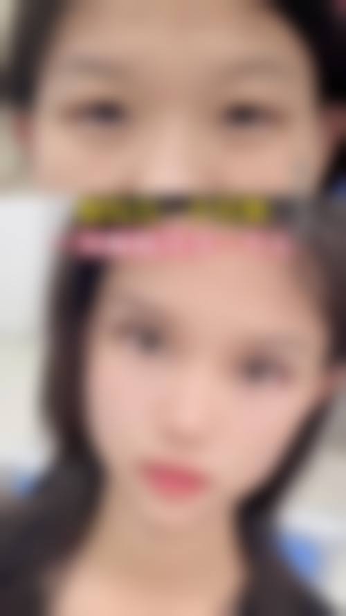 任烨眼鼻综合水平怎么样可靠吗？