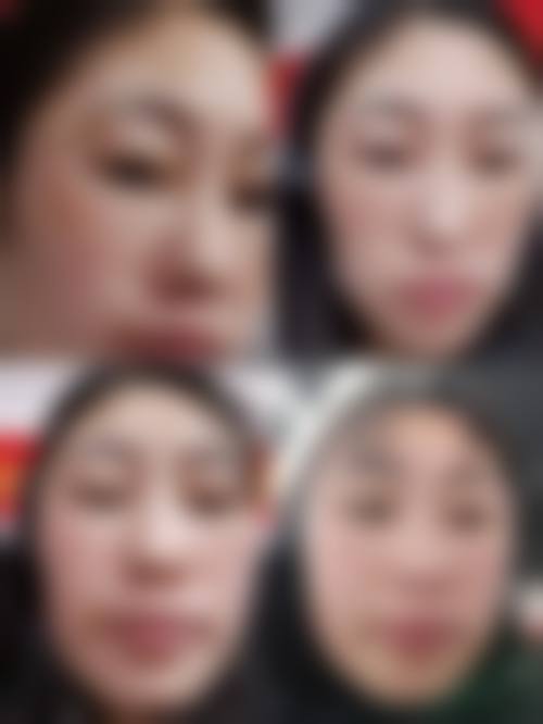 陈剑祛黄褐斑水平怎么样可靠吗？