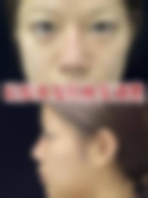 任烨怎么预约？