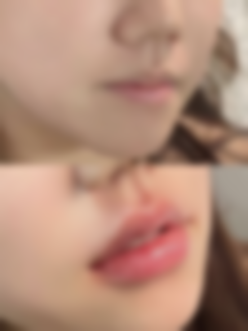 四、台州黄岩形象达人医疗美容门诊部实例