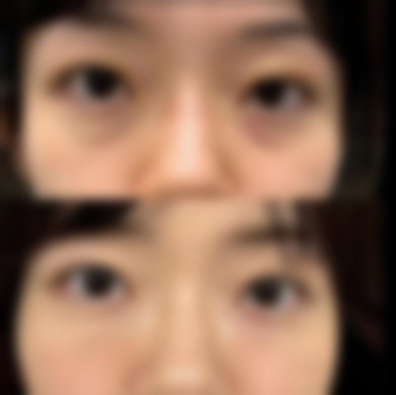 钱雪华治疗颈腰椎疾病水平怎么样可靠吗？