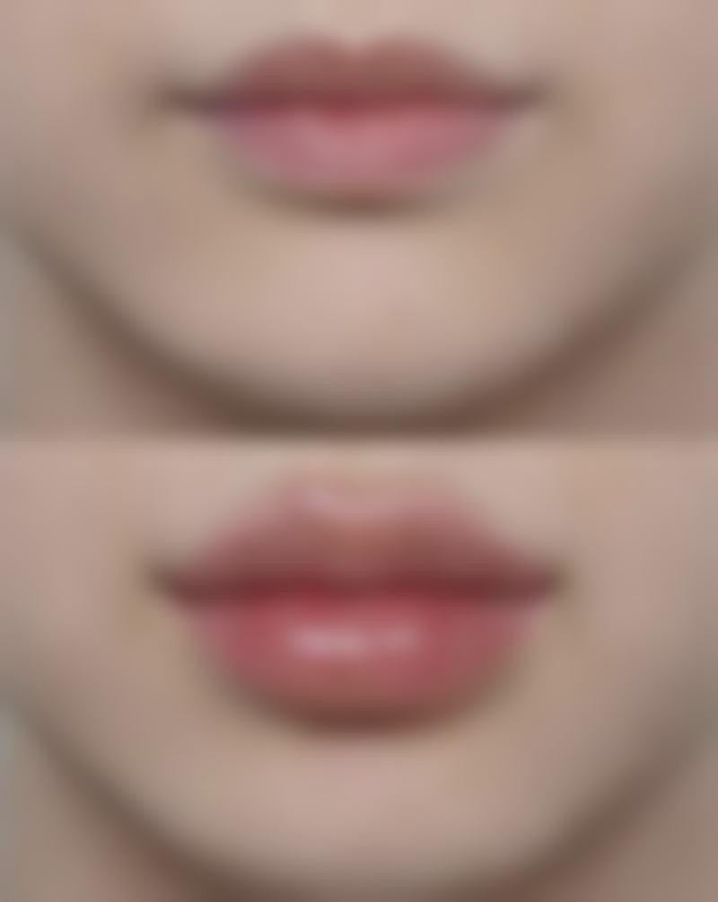 四、北京佰嘉利整形医疗美容实例