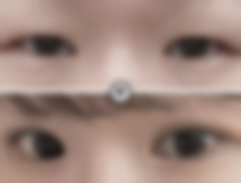 冀宇全身各部位吸脂水平怎么样可靠吗?