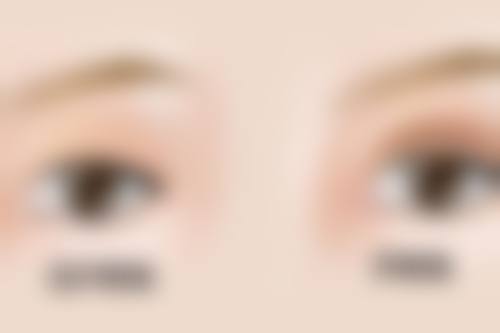 五、成都悦美倾城整形医疗美容诊所实例