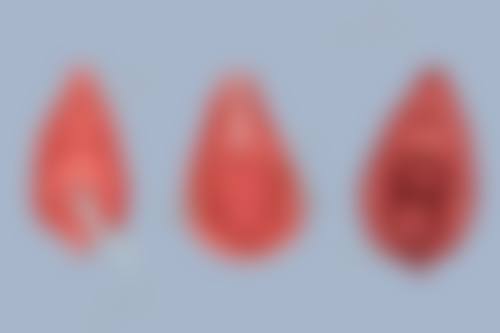 做隆胸多久能修复自然?术后早期修复要点