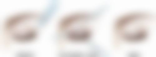 五、沈阳艾薇美（伊美尔）医疗美容医院怎么预约：