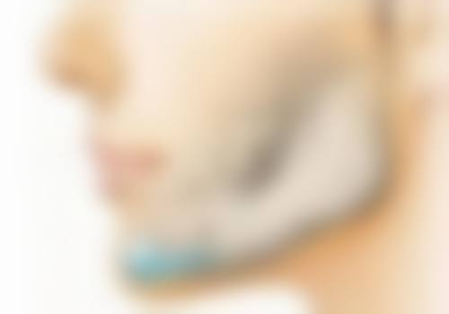 选择合适的医院和医生助力修复