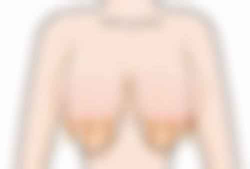 四、沈阳艾薇美（伊美尔）医疗美容医院实例