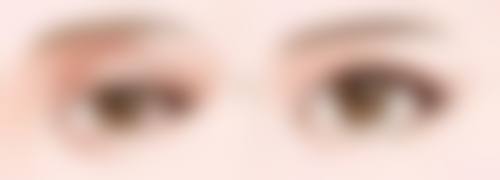 做隆胸多久能恢复自然？3 - 6 个月达稳定状态，各阶段恢复要点揭秘 