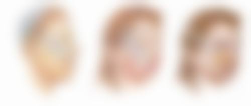 五、北京伊美尔美容爱康医院实例