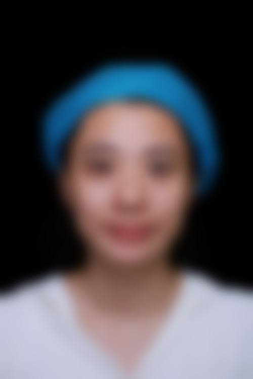 冀宇全身各部位吸脂实例