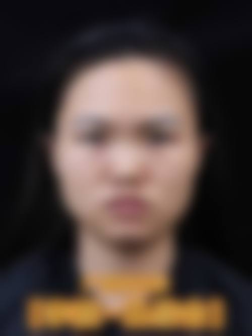 郭金才项目价格表参考