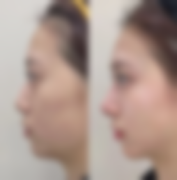 赵卿眼部整形水平怎么样可靠吗？