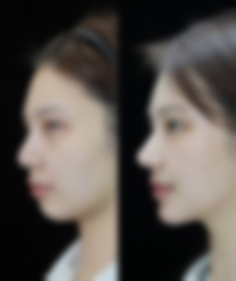 三、沈阳艾薇美（伊美尔）医疗美容医院基本信息：