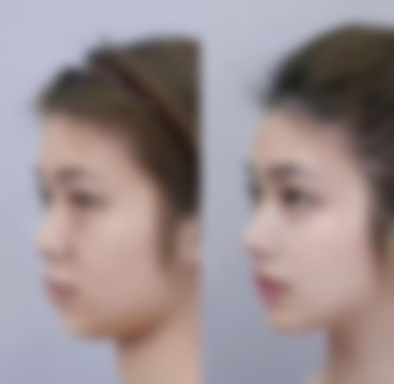 六、大理吴氏嘉美医疗美容怎么预约：