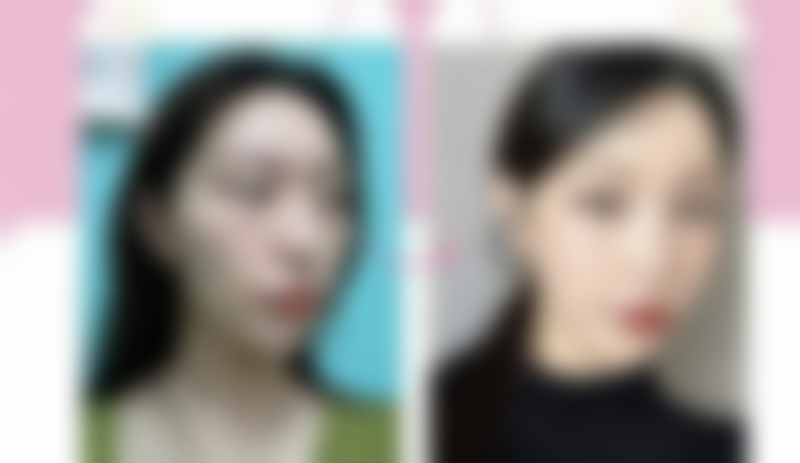 张策怎么预约？