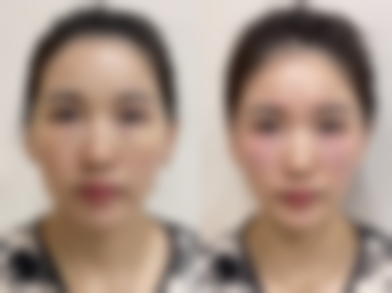 四、北海柏悦医疗美容诊所实例